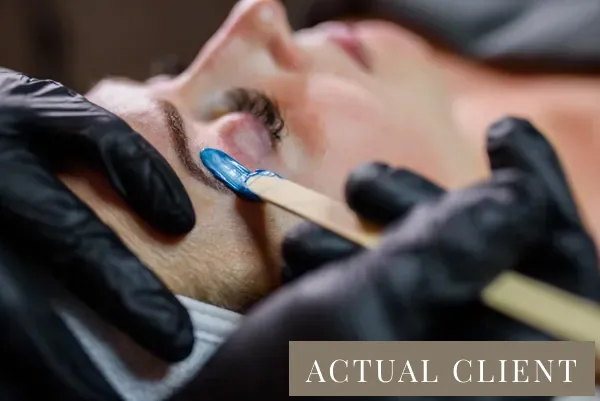 A patient undergoing eyebrow treatments