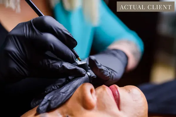 A patient undergoing microblading treatment